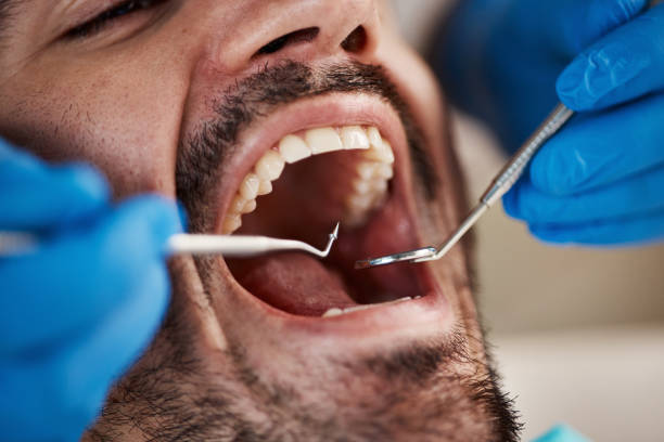 Best Chipped Tooth Repair Near Me  in Ocean Grove, MA